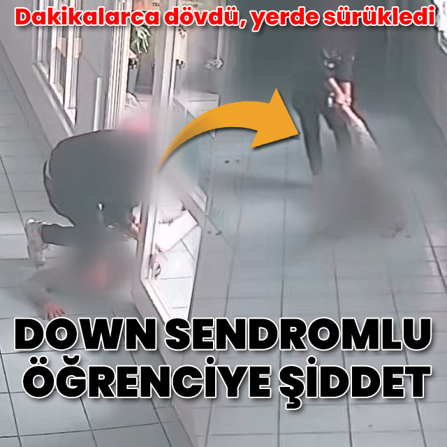 Down sendromlu öğrenciye şiddet: Dövdü, yerde sürükledi