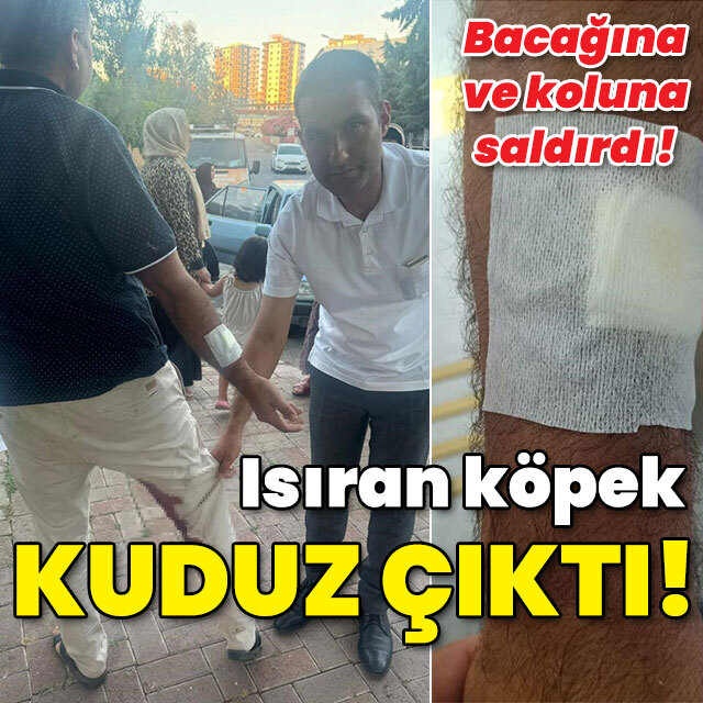Karantinaya alındı! Isıran köpek kuduz çıktı!