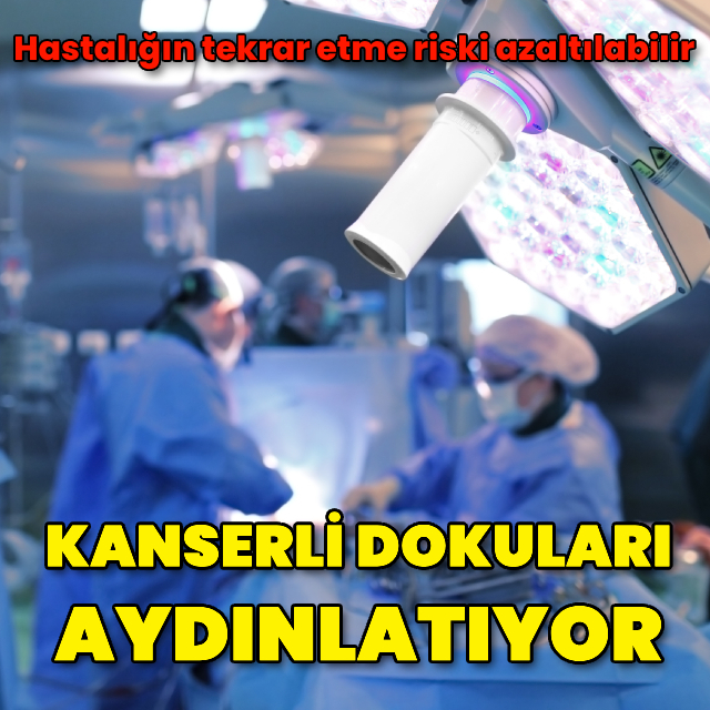 Kanserli dokuları aydınlatıyor! Hastalığın tekrar etme riski azaltılabilir