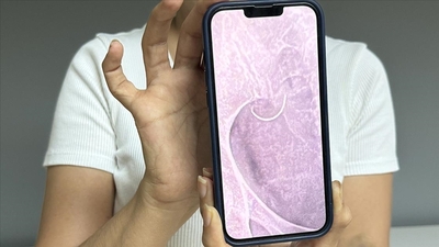 1.5 yıldır karnında unutulan iğneyle yaşıyor