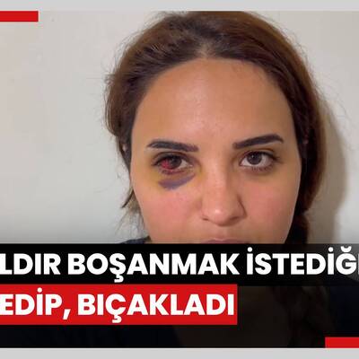 Bir yıldır boşanmak istediği eşi darbedip, bıçakladı