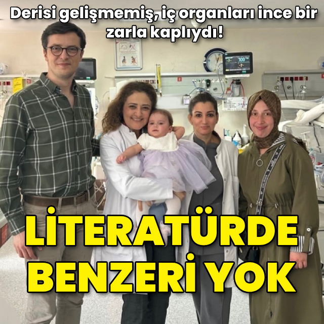 Literatürde benzeri yok!