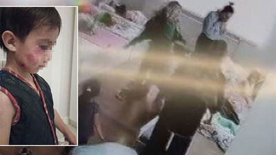 Biri 4, diğeri 3 yaşında! Kulağı kopma noktasına geldi! Kreşte dehşet!