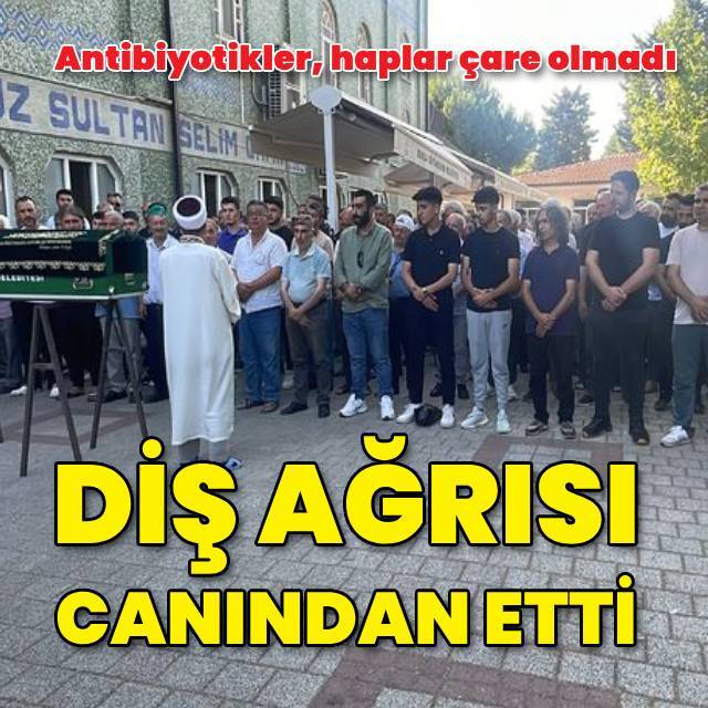 Diş ağrısı canından etti
