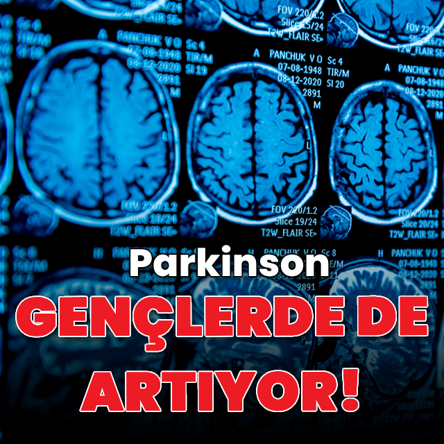 Genç yaşta Parkinson vakaları artıyor!