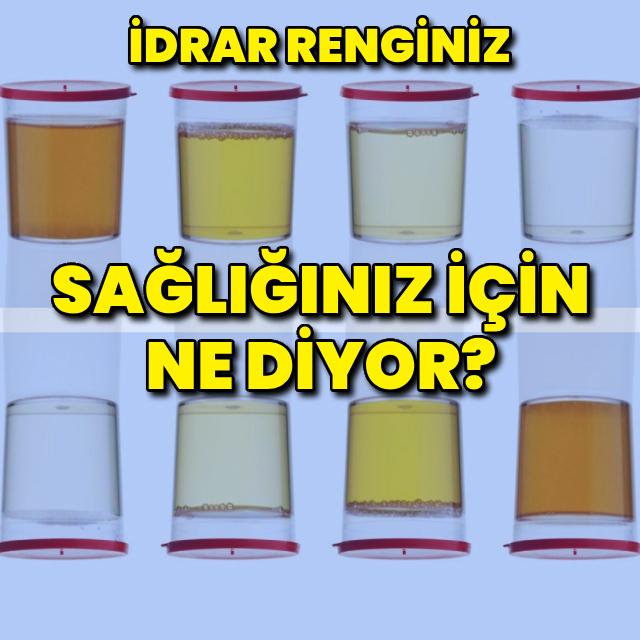 İdrar renginiz sağlığınız hakkında ne söylüyor?