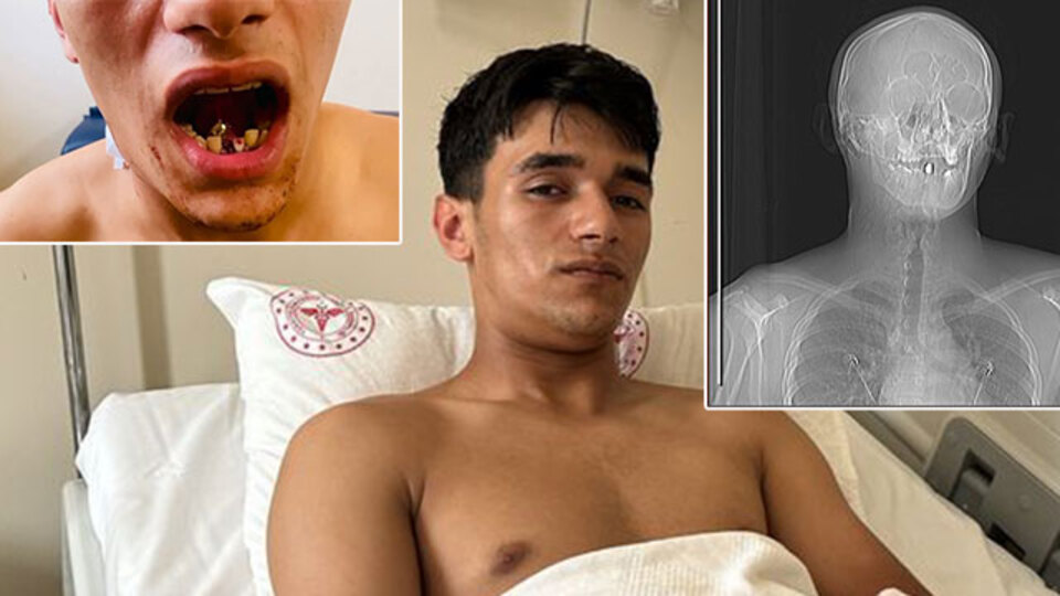 Boynundan giren mermi çenesine saplandı! Bunun adı: Mucize!