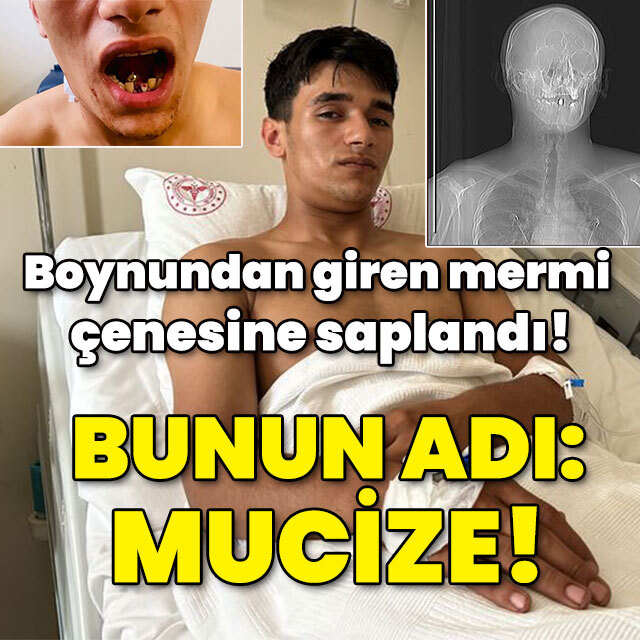 Boynundan giren mermi çenesine saplandı! Bunun adı: Mucize!