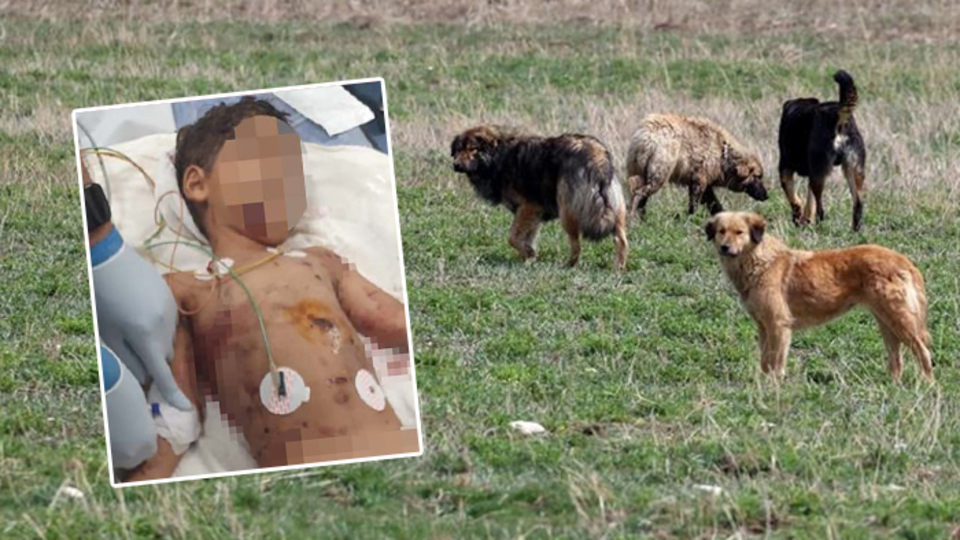 5 yaşındaki çocuğa köpek saldırdı