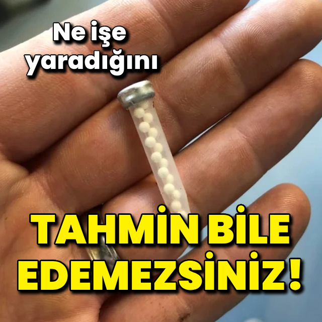 Ne işe yaradığını tahmin bile edemezsiniz!