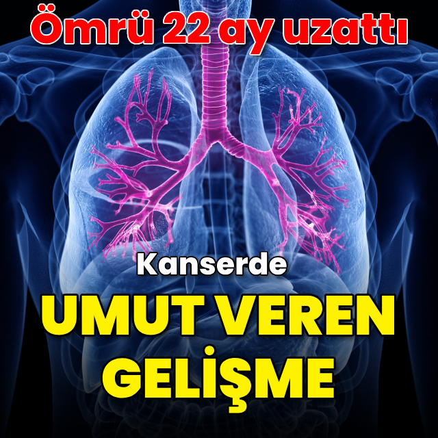 Kanserde umut veren gelişme! Akıllı ilaçlar, ömrü 22 ay uzattı