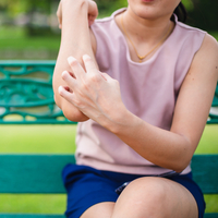 Sivrisinek ısırıklarında yapılan bu hata ikinci enfeksiyon sebebi!