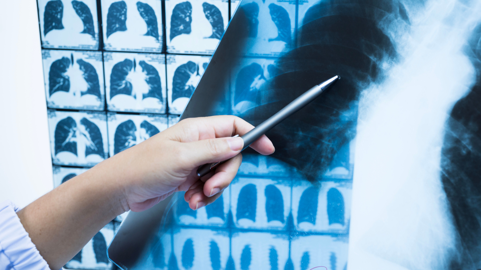 Kanser sanılıyordu, biber parçası çıktı!