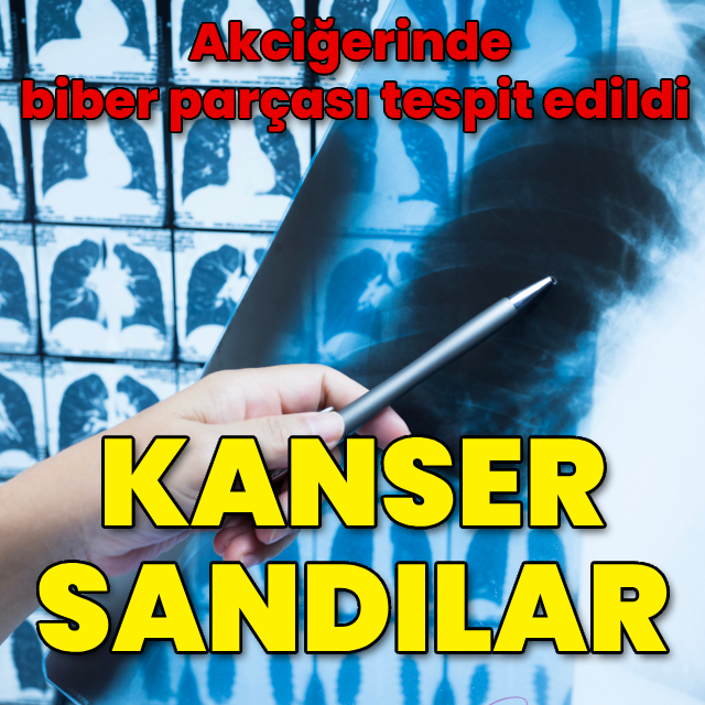 Kanser sanılıyordu, biber parçası çıktı!