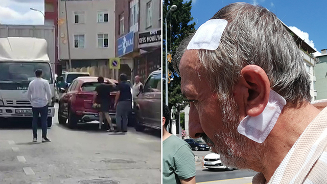 Trafikte bijon anahtarlı saldırıya gözaltı