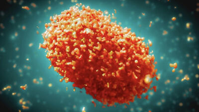 Türkiye'de maymun çiçeği vakası var mı?