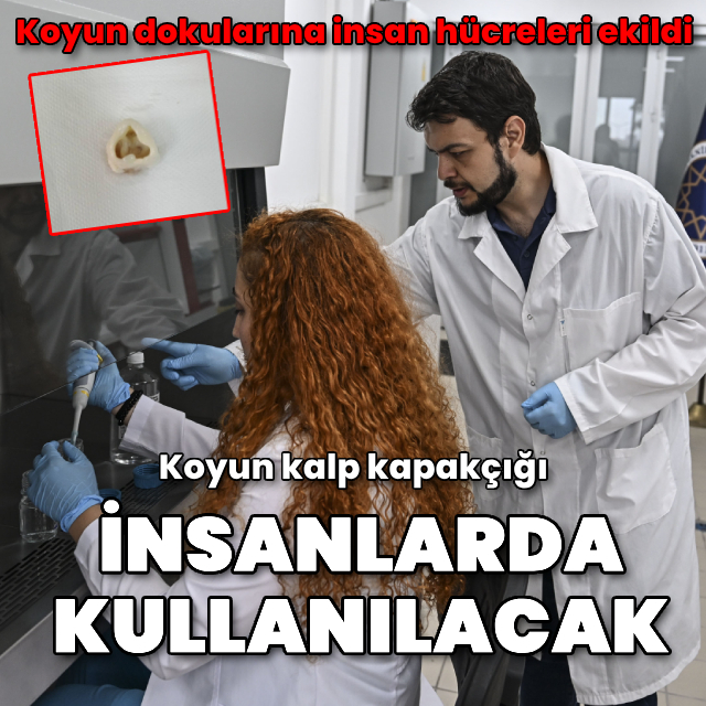 Koyun kalp kapakçığı insanlarda kullanılacak