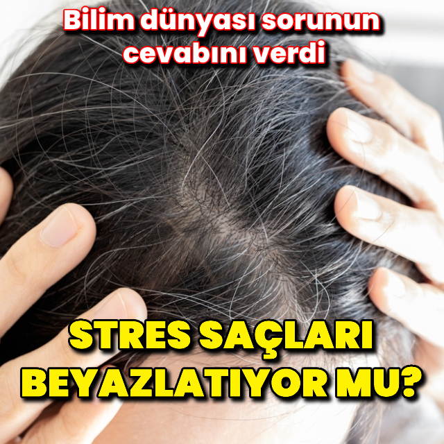 Stres saçları beyazlatıyor mu? Bilim dünyası sorunun cevabını verdi