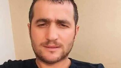 Acı olay: Arı soktuktan sonra öldü!