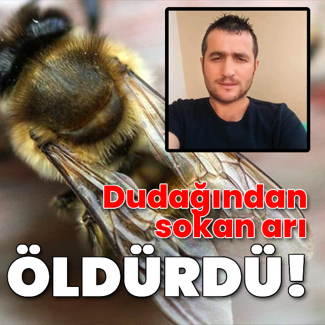 Acı olay: Arı soktuktan sonra öldü!