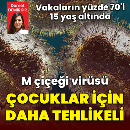  M çiçeği virüsü çocuklar için daha tehlikeli!