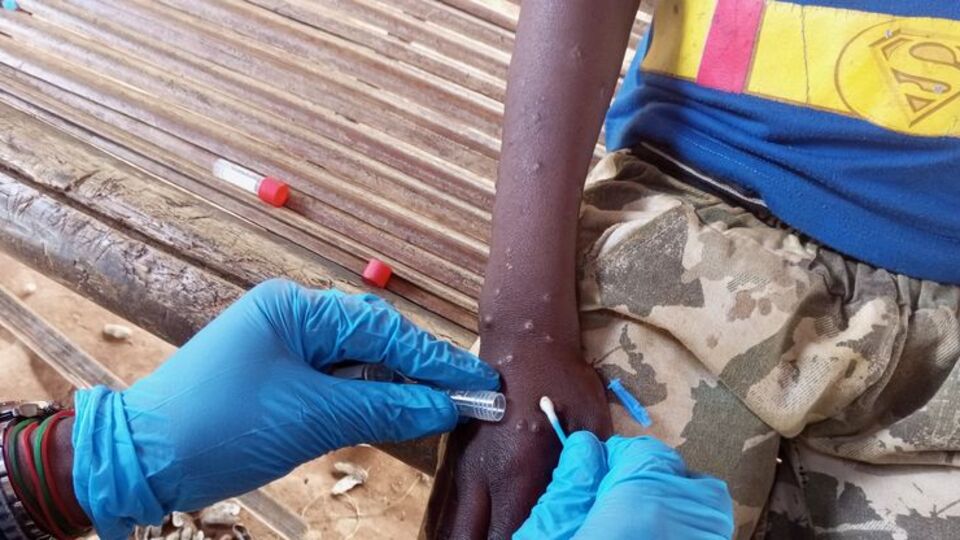 Avrupa'dan M çiçeği virüsü çağrısı