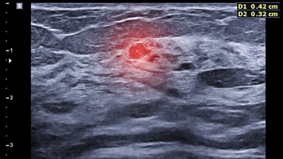 Aile hekiminin uyarısı hayat kurtardı!