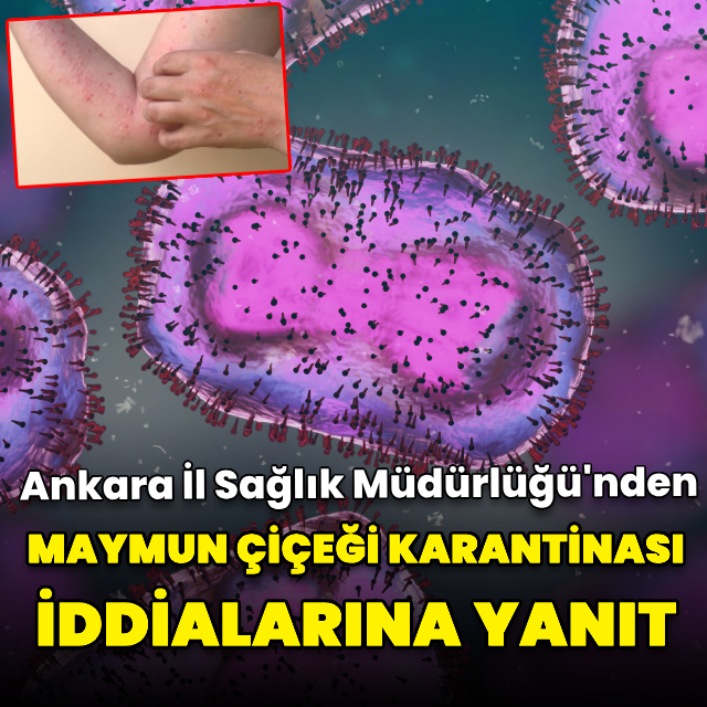 Ankara'da maymun çiçeği karantinası iddiasına yanıt