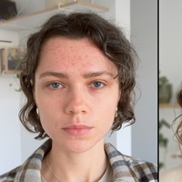 Hangi cilt sorununa hangi besin iyi gelir?