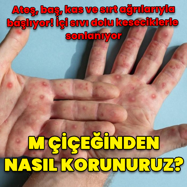 M çiçeğinden nasıl korunuruz?