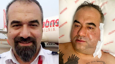 "Uçuşa gidiyorum" diyerek ameliyata girdi, hayatını kaybetti!