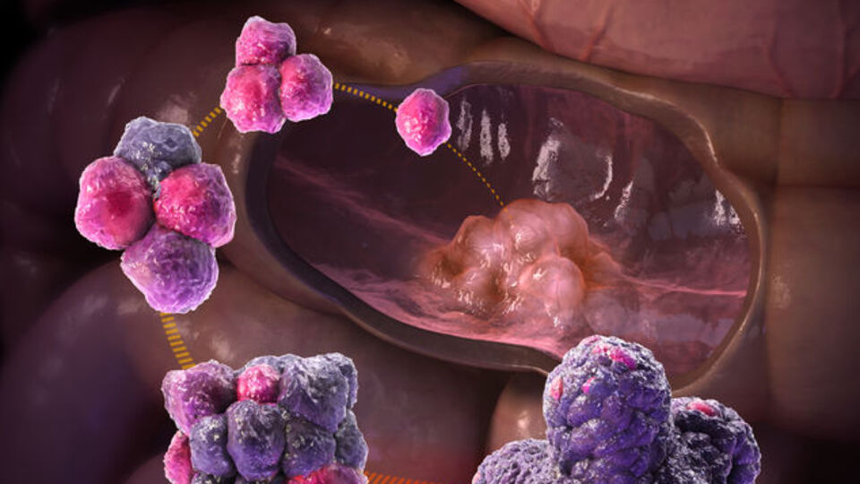 Yargıdan 800 bin liralık ilaç için 'SGK ödesin' kararı