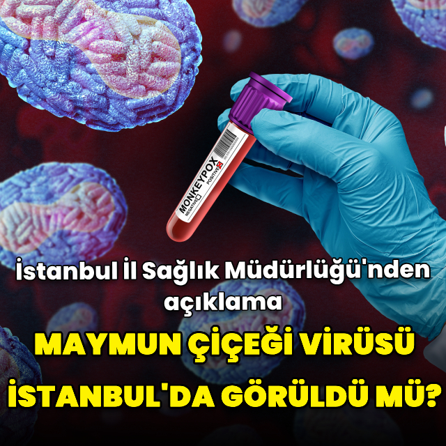 M çiçeği virüsü İstanbul'da görüldü mü? İstanbul İl Sağlık Müdürlüğü'nden açıklama