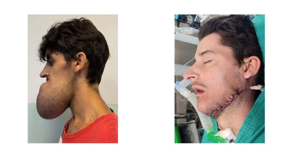 Gönüllü Türk hekimler, Kosova'da şifa dağıttı