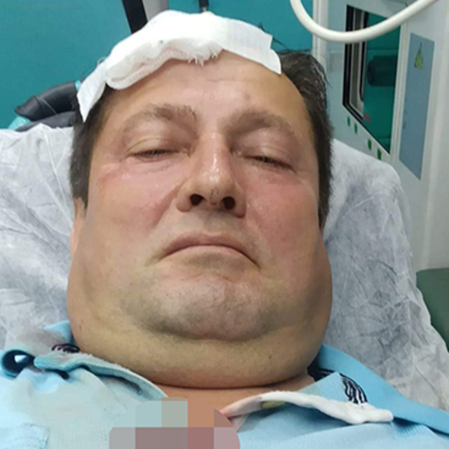 Balkonda otururken yorgun mermi isabet etti