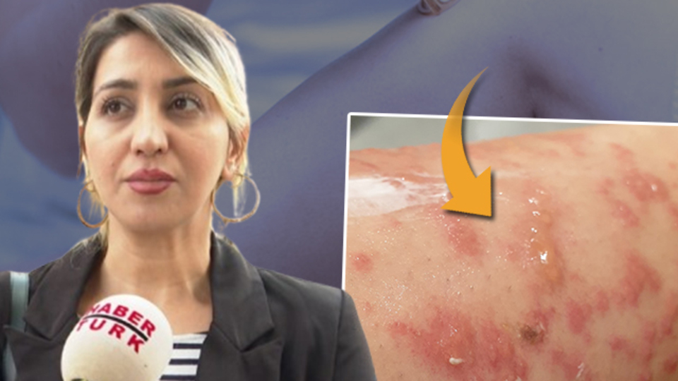 İranlı turist, güzelleşmek için İstanbul'a geldi kabusu yaşadı