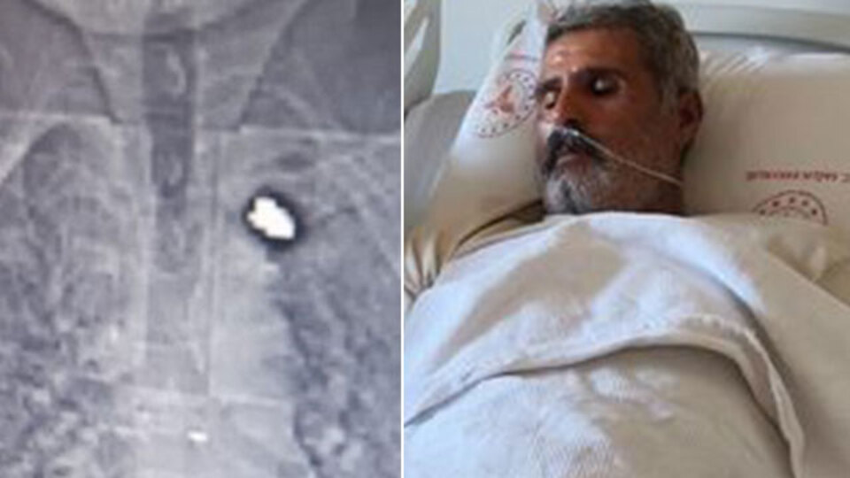 Uyurken vuruldu! Kurşun göğsüne takıldı!