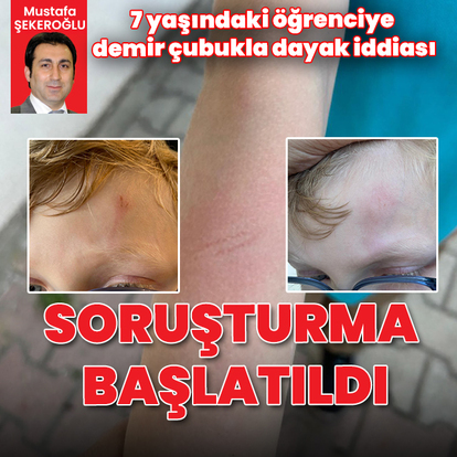 7 yaşındaki öğrenciye demir çubukla dayak iddiası: Soruşturma başlatıldı