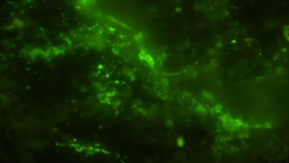 Dünyanın en eski mikrobu bulundu!