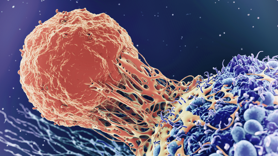 Erken yaşta kanser vakalarında artış: 'Halk sağlığı krizine dönüşmesi an meselesi'