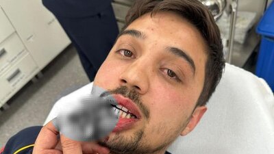 Kalp krizi geçiren hastayı taşıyan ambulansın önünü kestiler!