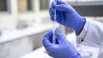 "Covid-19 testi verenlerin yarısı pozitif çıkıyor"