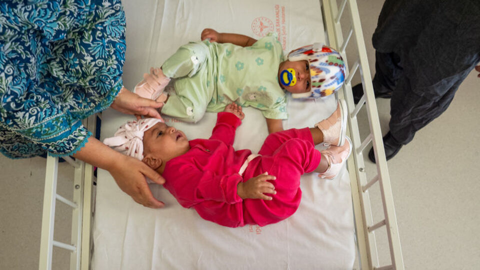 Operasyonla ayrılan Pakistanlı yapışık ikizler taburcu edildi