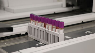 Mikrobiyota analizi meme kanserinin tanı ve tedavisine ışık tutacak