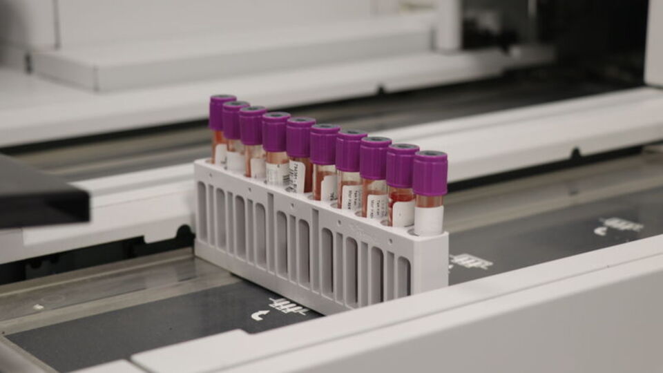 Mikrobiyota analizi meme kanserinin tanı ve tedavisine ışık tutacak