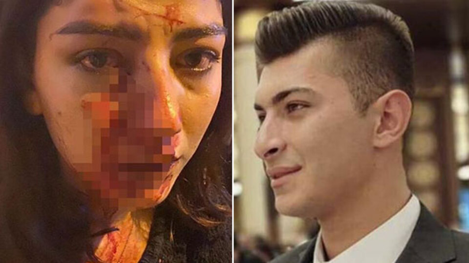 Genç kadının burnunu kırmıştı! Serbest!