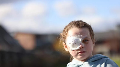 Elektronik sigara patladı, kız çocuğu gözünü kaybetti