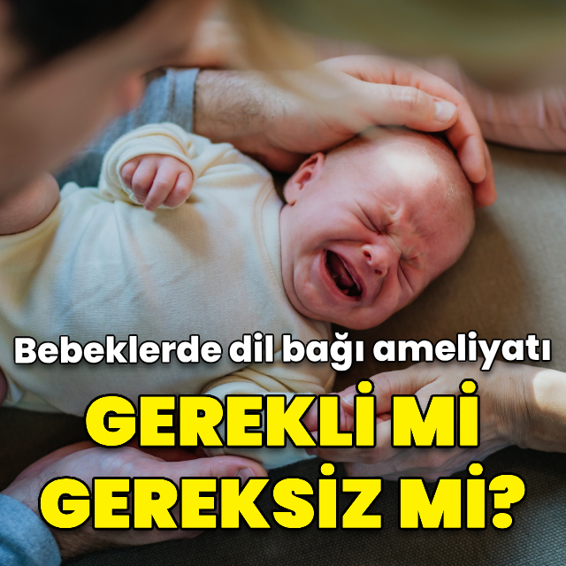 Bebeklerde dil bağı ameliyatı! Gerekli mi, gereksiz mi?
