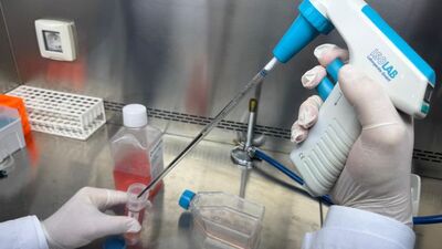 Kandan meme kanseri tespit edilmesi hedefleniyor