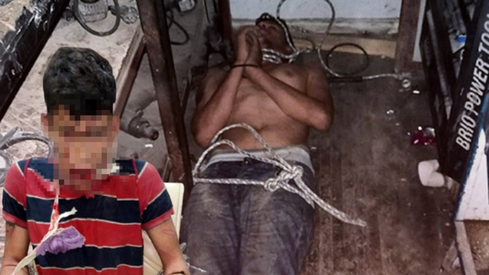 Genç işçiye korkunç işkence: Dövdüler, dişlerini kırıp, böcek yedirdiler